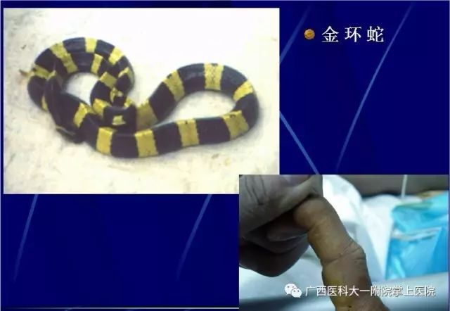 红毒蛇奥伯伦复活_红毒蛇奥伯伦强吗_红毒蛇奥伯伦 长城